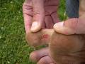 Thumb 98